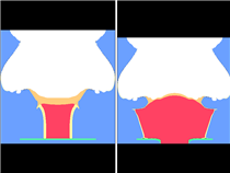 ALE Card Gap Test Simulation